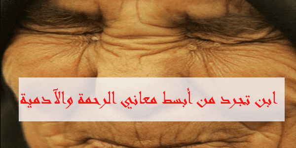 أشعل النيران في أمه من أجل "ملاليم"
