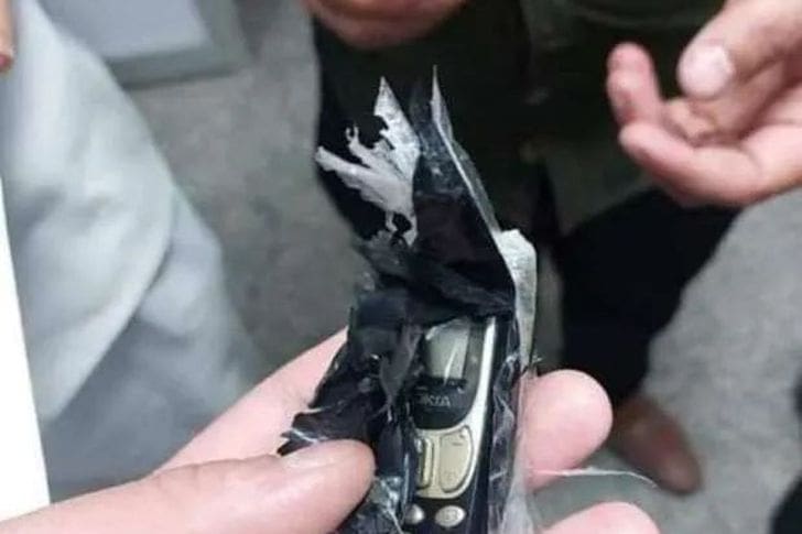 استخراج هاتف محمول من بطن مريض