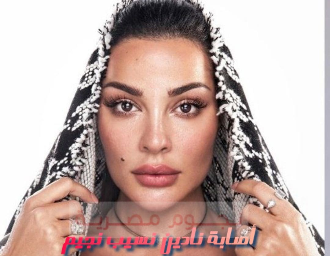 إصابة نادين نسيب نجيم