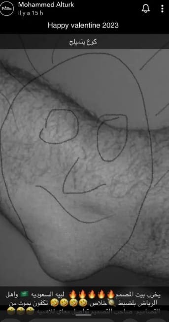 محمد الترك يسخر من شكل وجه دنيا بطمة