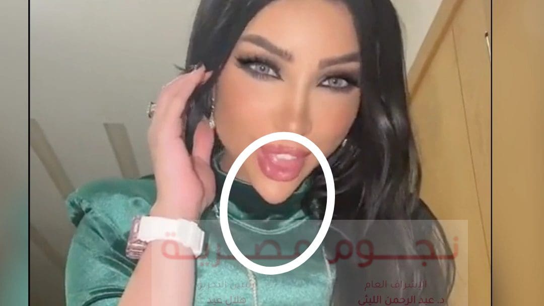 محمد الترك يسخر من شكل وجه دنيا بطمة المثلث