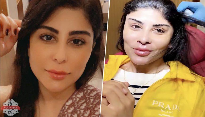 زارا البلوشي في أحدث ظهور بعد عمليات التجميل.. فيديو