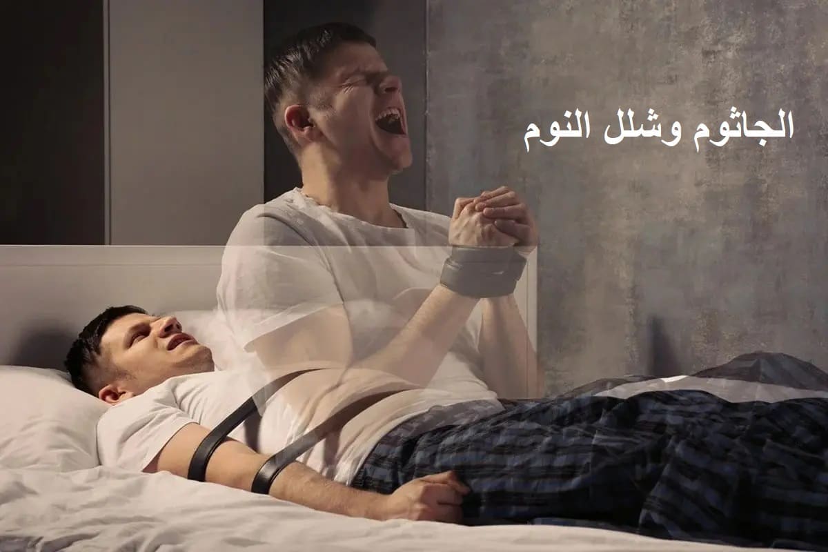 المسند يكشف عن ماهية الجاثوم "شلل النوم" والحل الوحيد لعلاجه ويؤكد أنه يصيب 3 من كل 10 أشخاص